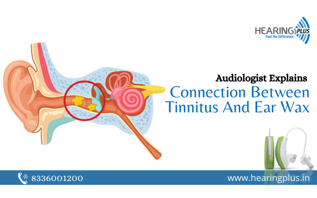 Audiologist Explains The Connection Between Tinnitus And Ear Wax