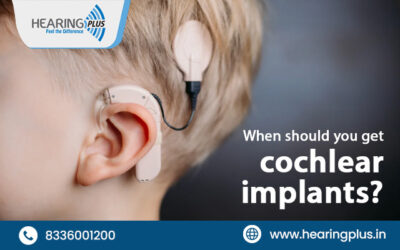 When should you get cochlear implants?